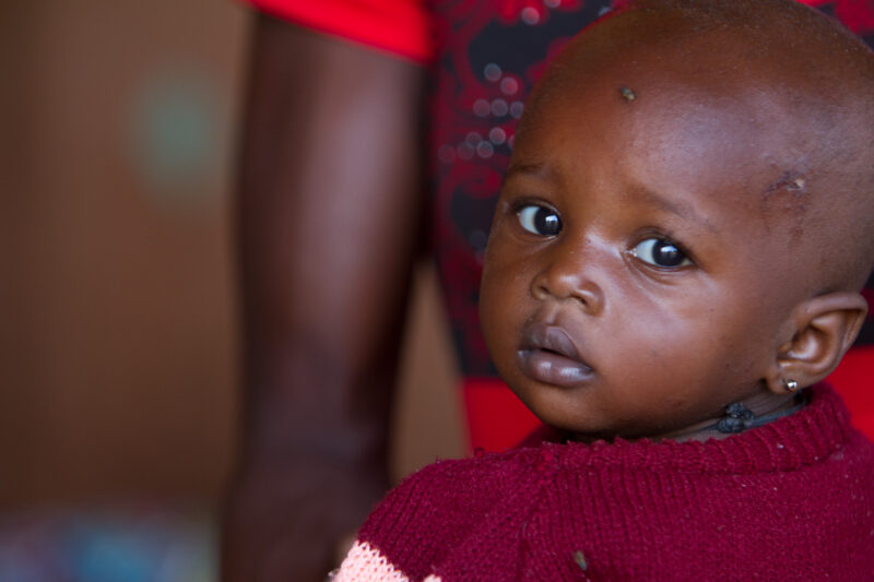 Malnourished in Burkina Faso — Babies living in a region of Burkina faso going through a severe drought show signs of being malnourished. — Africa, West Afri...