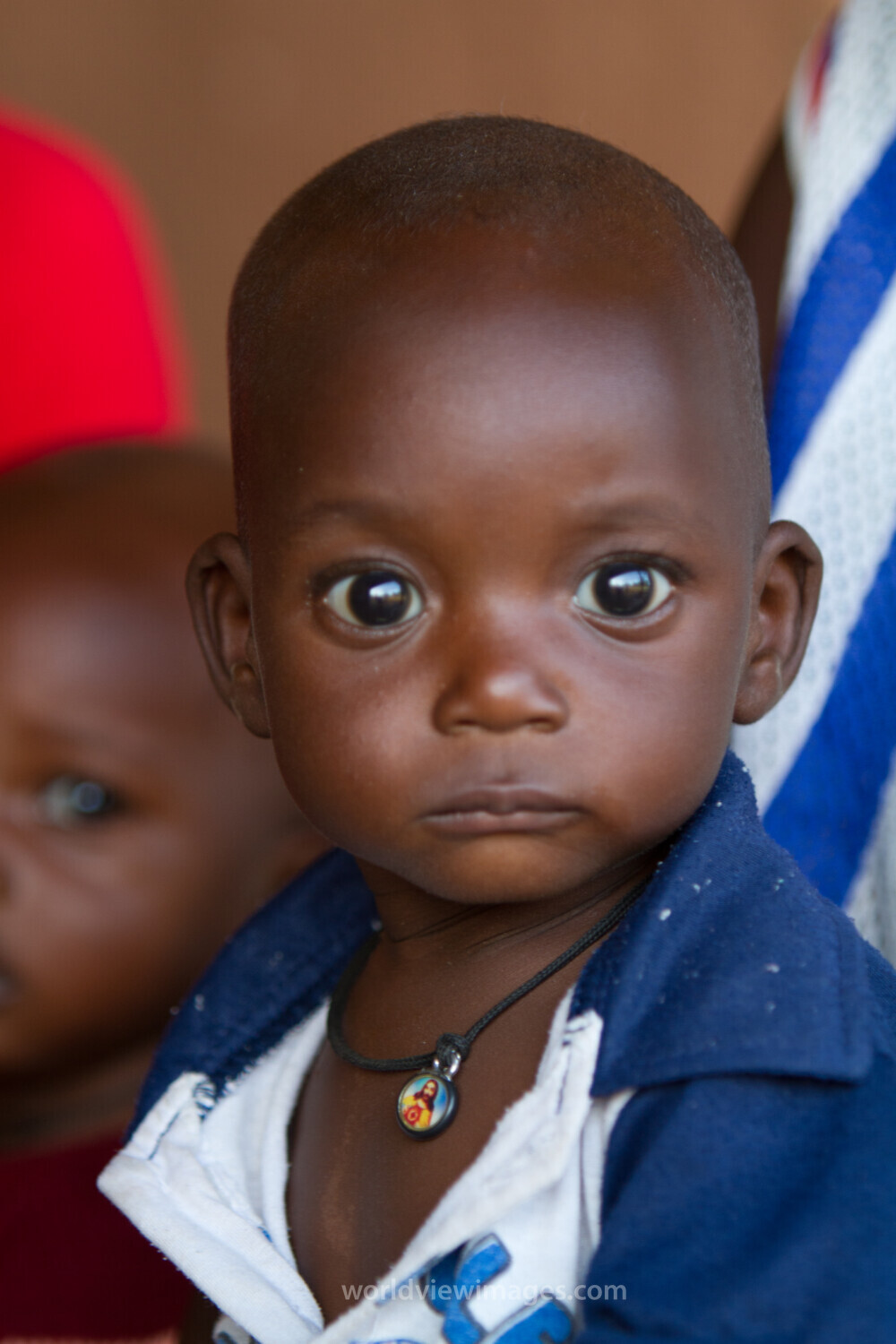 Malnourished in Burkina Faso