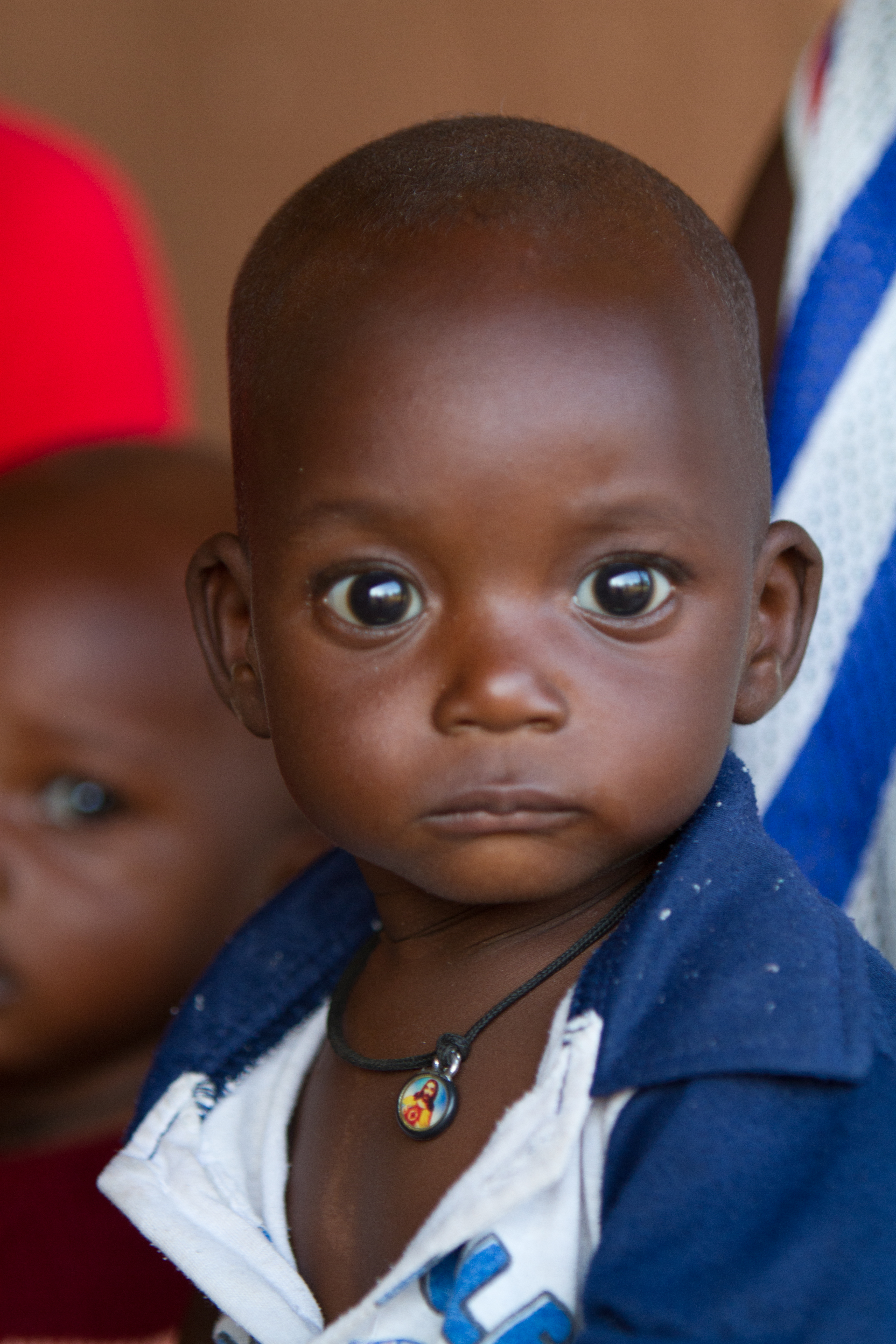 Malnourished in Burkina Faso