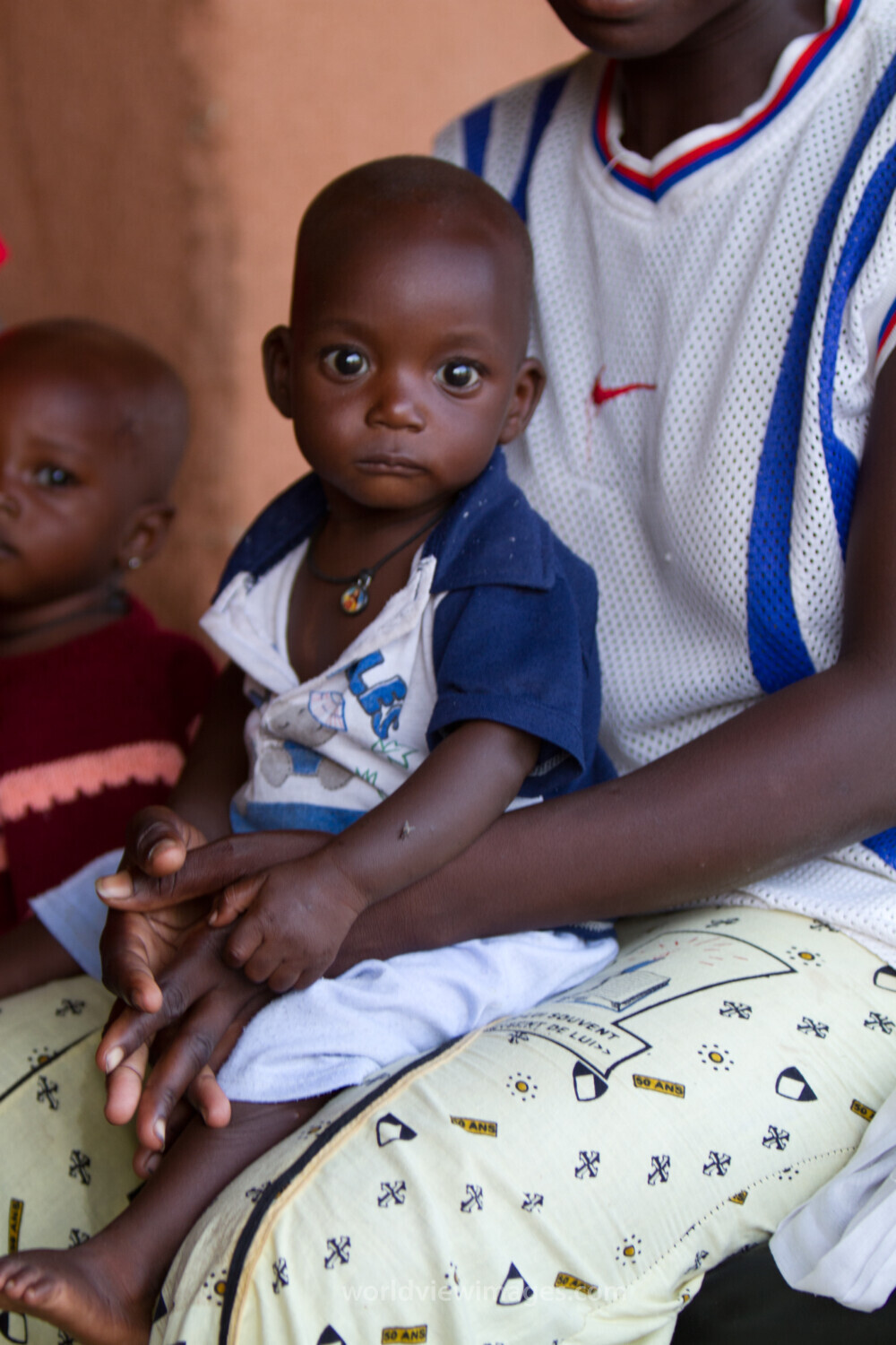 Malnourished in Burkina Faso