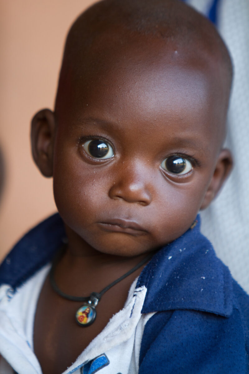 Malnourished in Burkina Faso — Babies living in a region of Burkina faso going through a severe drought show signs of being malnourished. — Africa, West Afri...