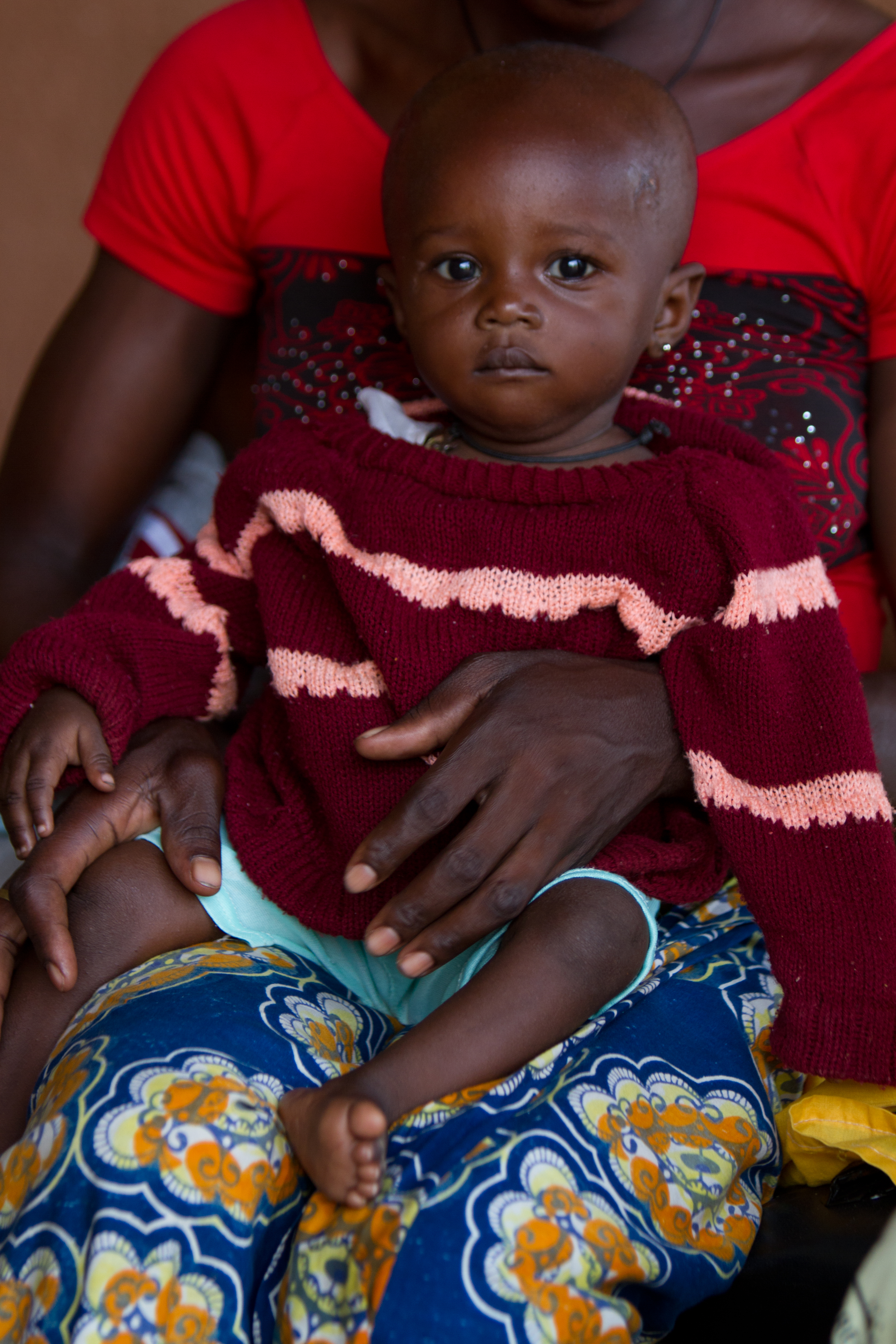 Malnourished in Burkina Faso
