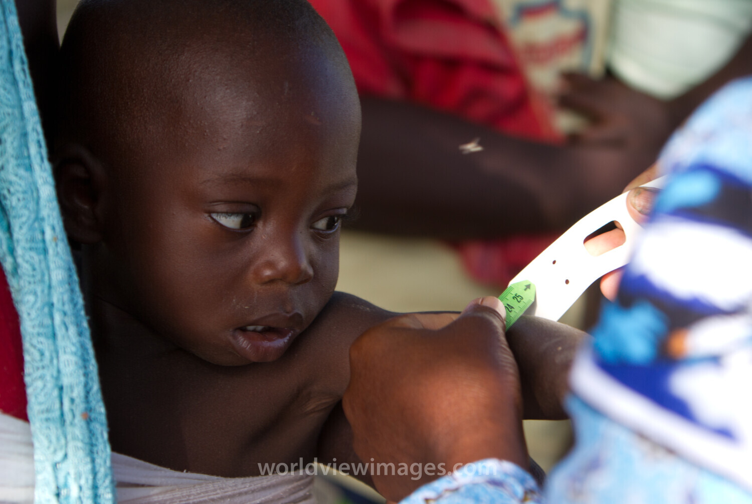 Checking for Malnourishment