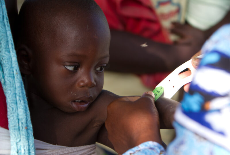 Checking for Malnourishment — Health workers check babies for signs of malnourishment by measuring their arms, at a remote village in Burkina Faso, Africa th...