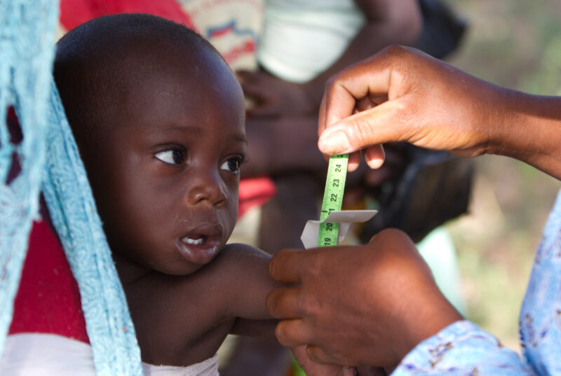 Checking for Malnourishment — Health workers check babies for signs of malnourishment by measuring their arms, at a remote village in Burkina Faso, Africa th...