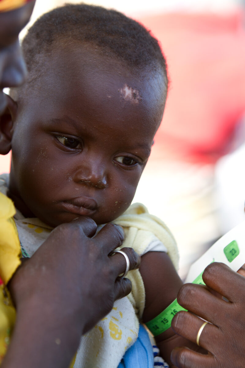 Checking for Malnourishment — Health workers check babies for signs of malnourishment by measuring their arms, at a remote village in Burkina Faso, Africa th...