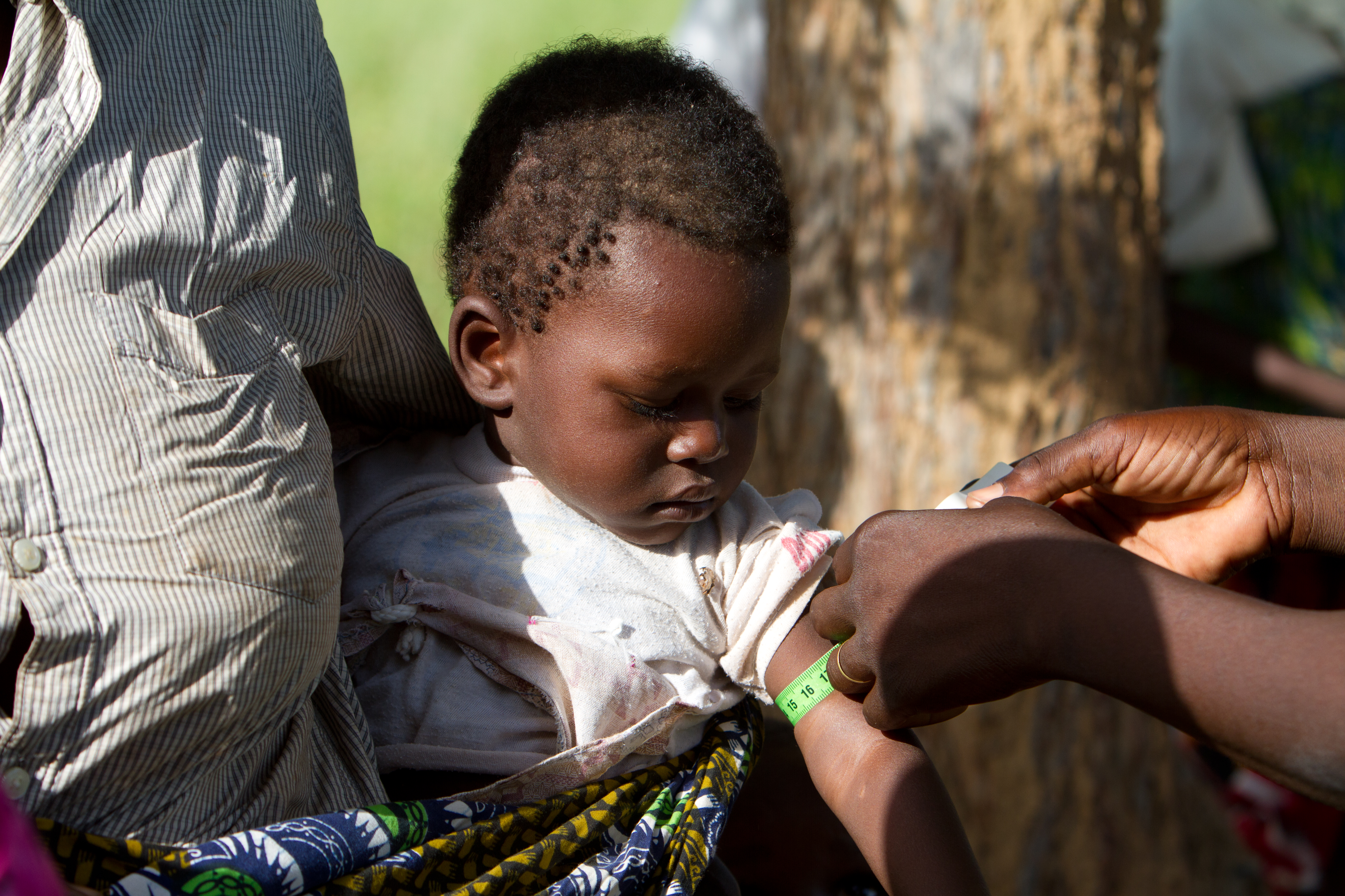 Checking for Malnourishment