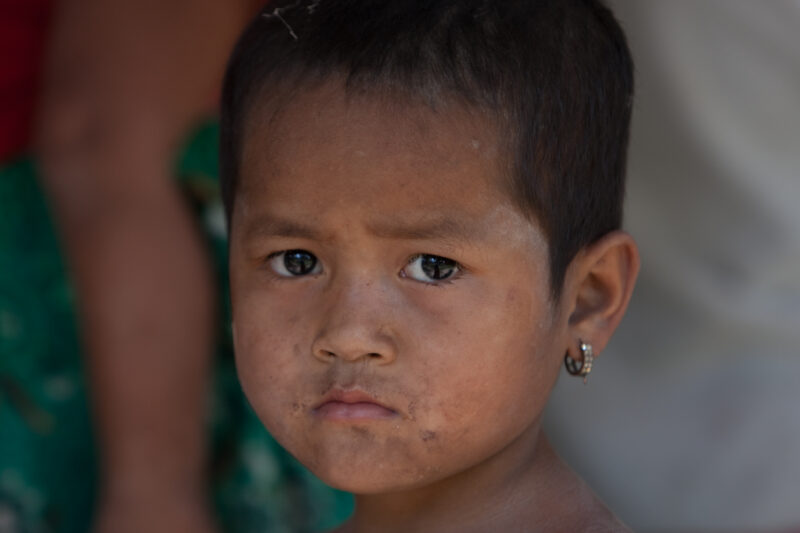 Girl Living in Poverty in Cambodia — Closeup of young girl living in poverty in rural Cambodia — Cambodia, faces, child, children, poor