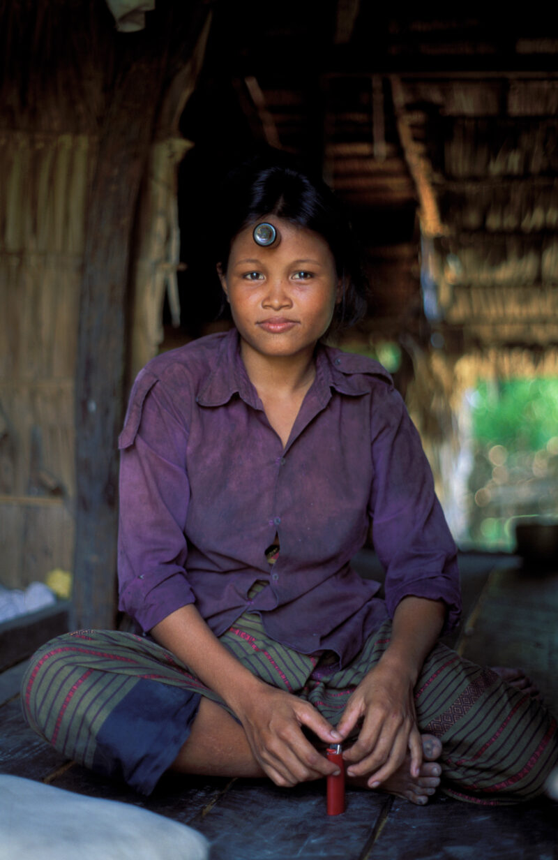 Woman in Cambodia — Young woman with a bottle stuck to her head throug suction — Cambodia, SE Asia, Poverty, woman, women