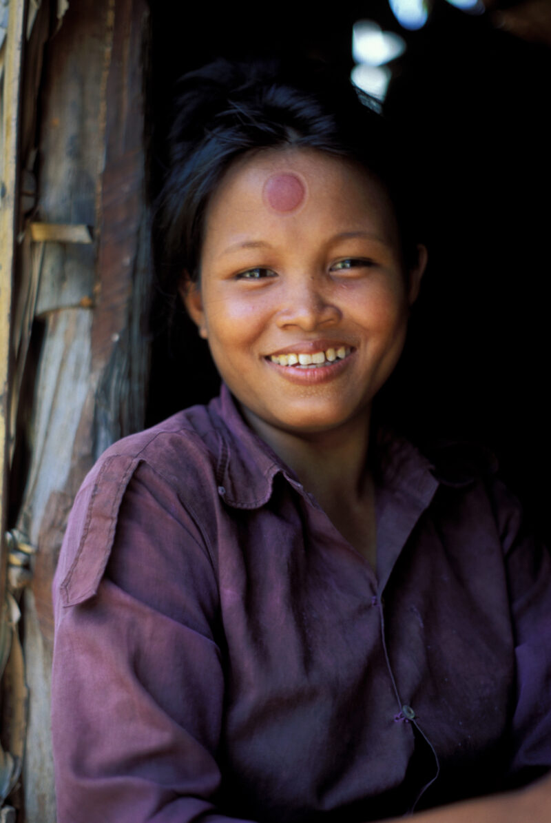 Woman in Camboda — Woman smiles in the doorway to her simple home after a local treatment for headache leaves a ring on her forhead. — Cambodia, SE Asia, Pov...