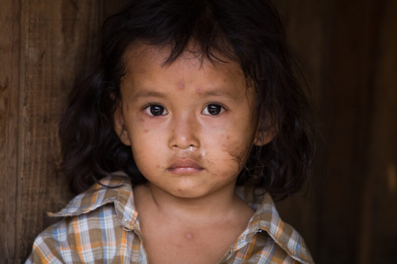 Children of Cambodia — Young girl growing up in poverty in rural Cambodia — Cambodia, faces, child, children, poor