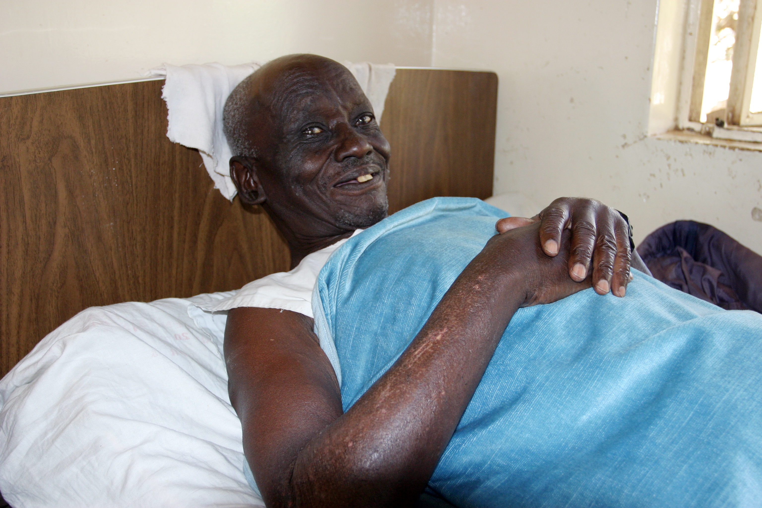 HIV/AIDS Patient in Hospital in Africa
