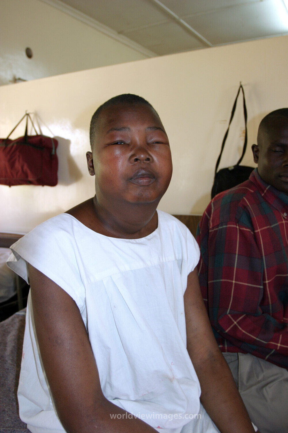 HIV/AIDS Patient in Hospital in Africa