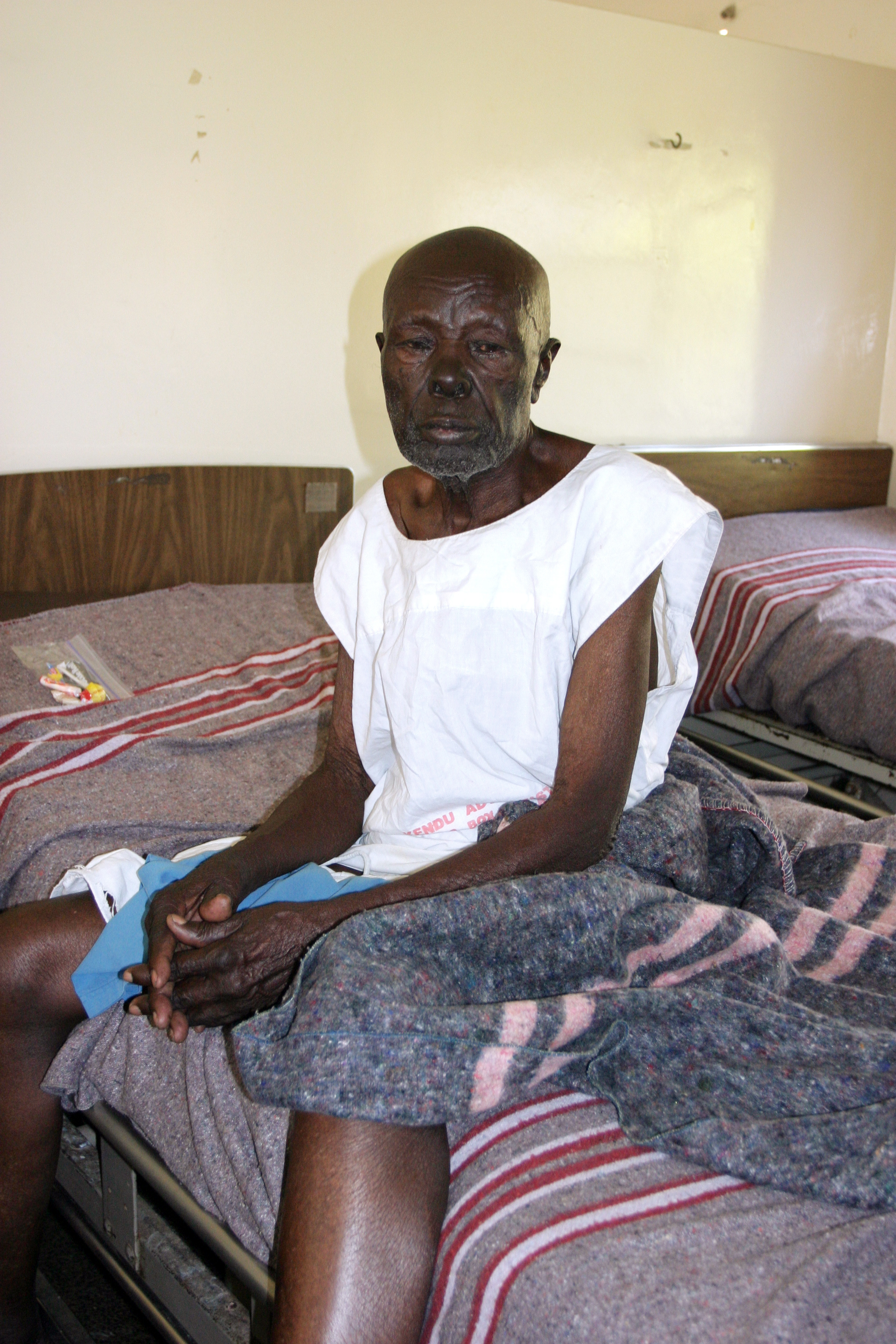 HIV/AIDS Patient in Hospital in Africa