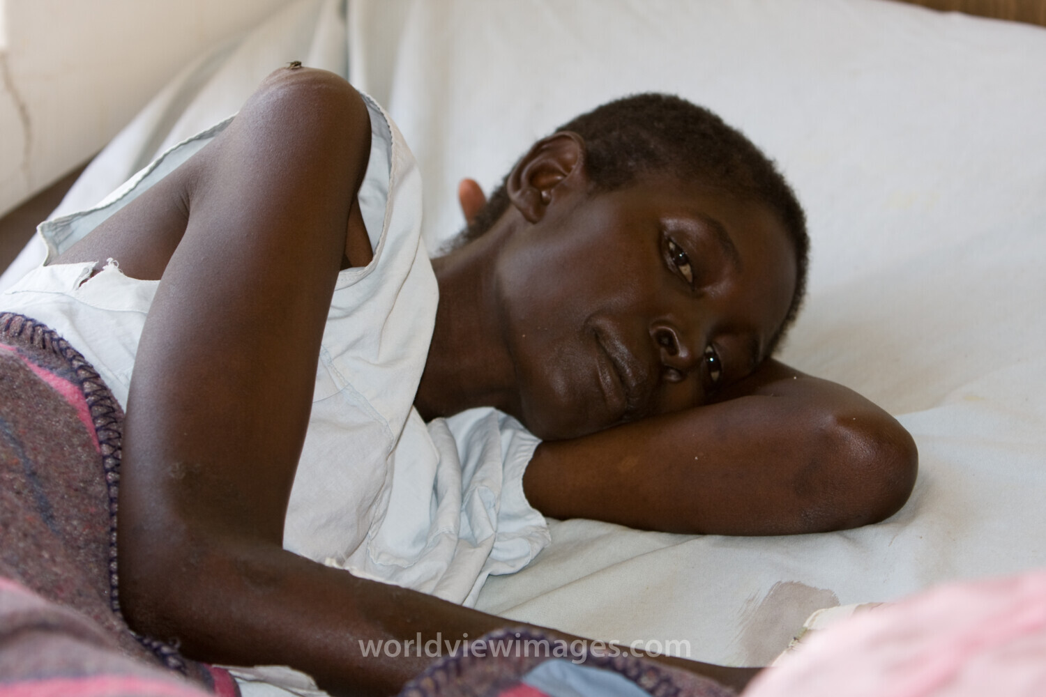 HIV/AIDS Patient in Hospital in Africa
