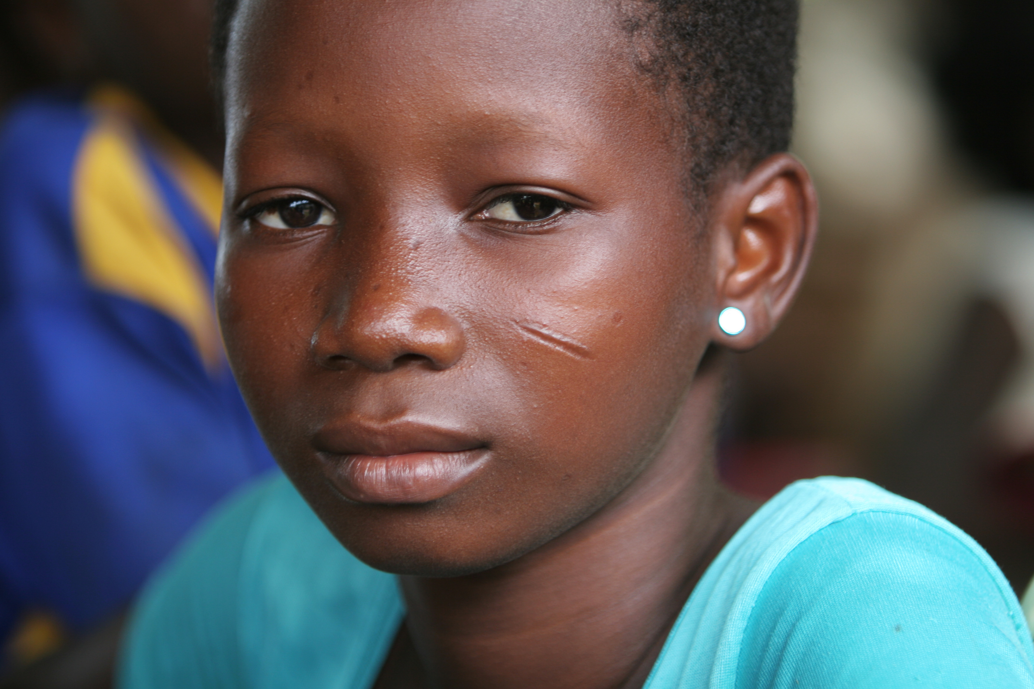 HIV/AIDS Awareness Education in Togo