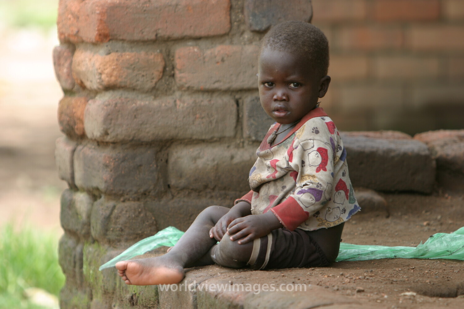 Baby in Malawi, Africa