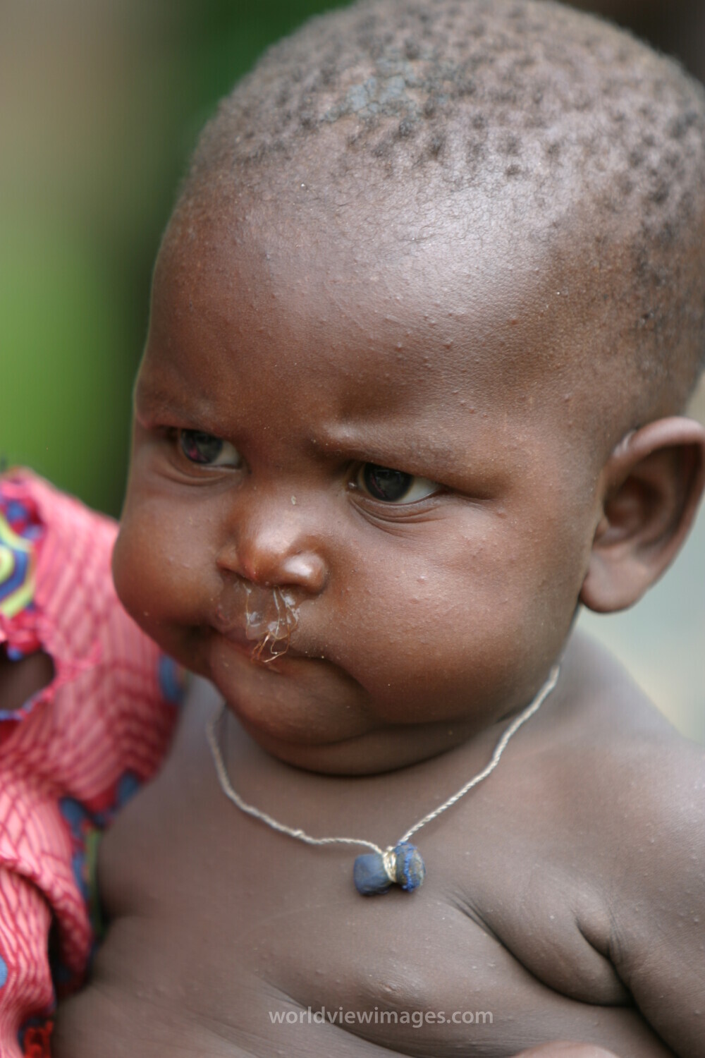 Baby in Malawi, Africa