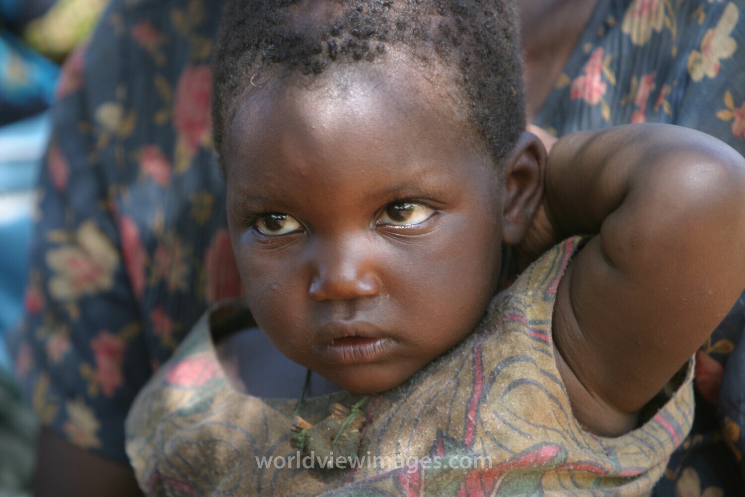 Baby in Malawi, Africa