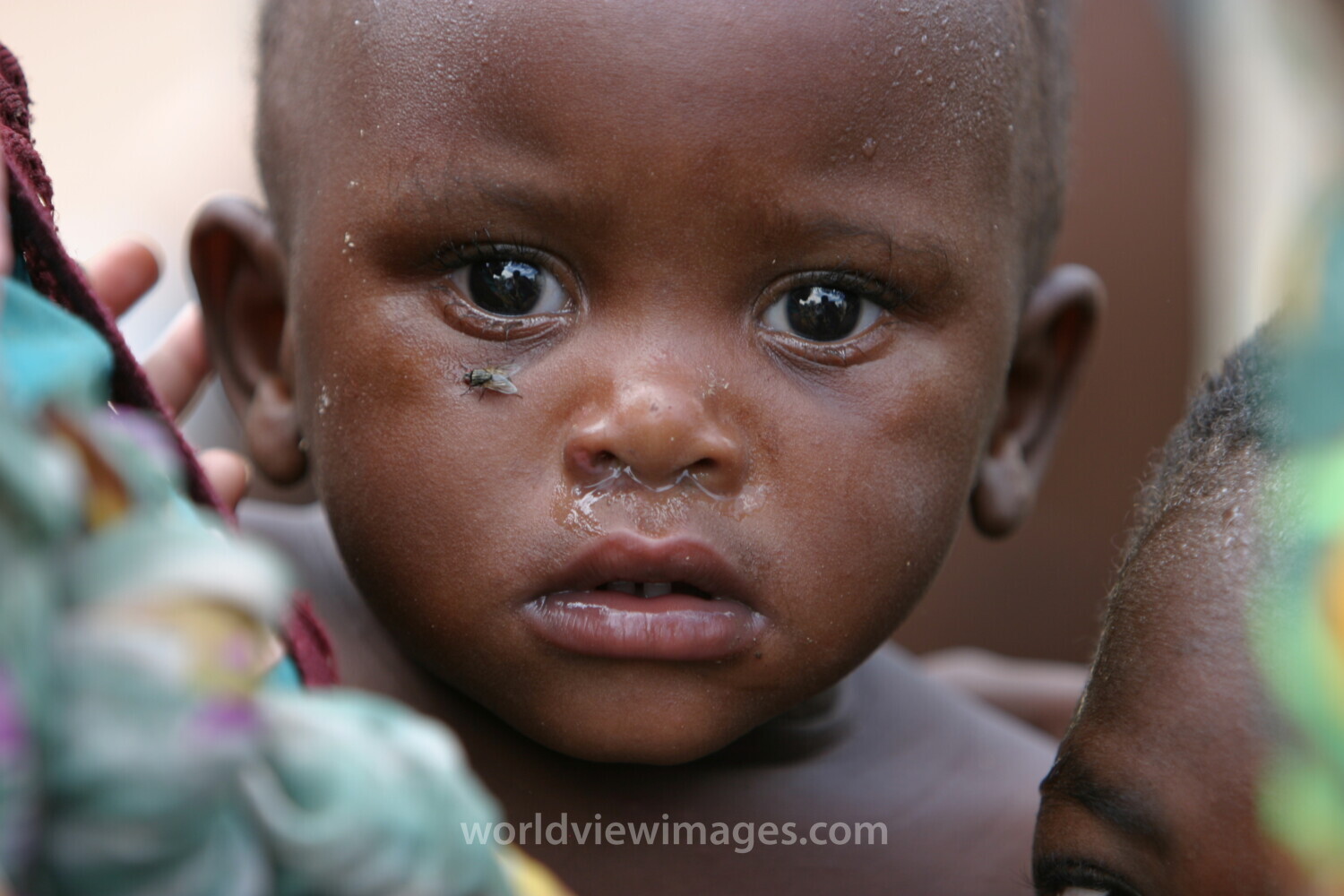 Boy in Malawi