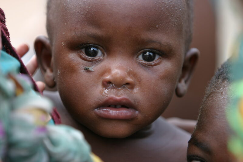 Boy in Malawi — Stock image of boy living in Malawi, Africa — Malawi, Africa, faces, boy, boys