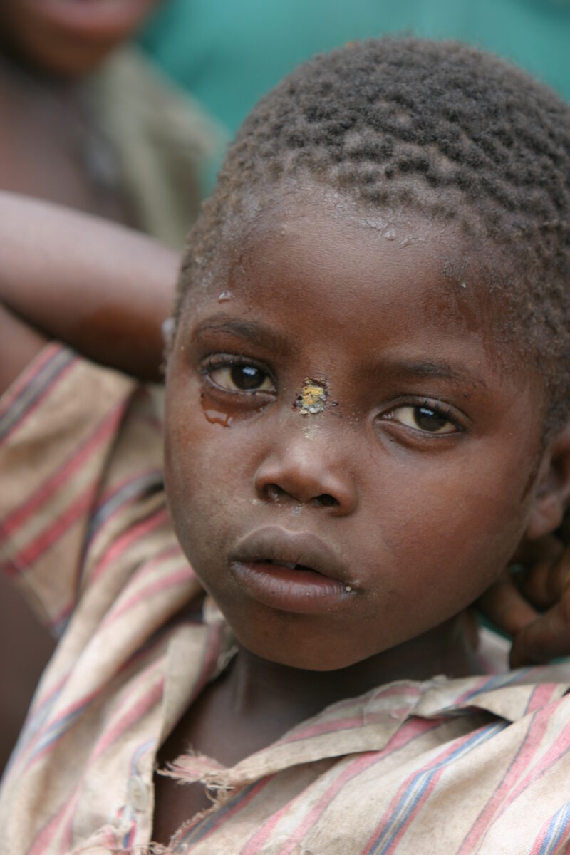 Boy in Malawi — Stock image of boy living in Malawi, Africa — Malawi, Africa, faces, boy, boys