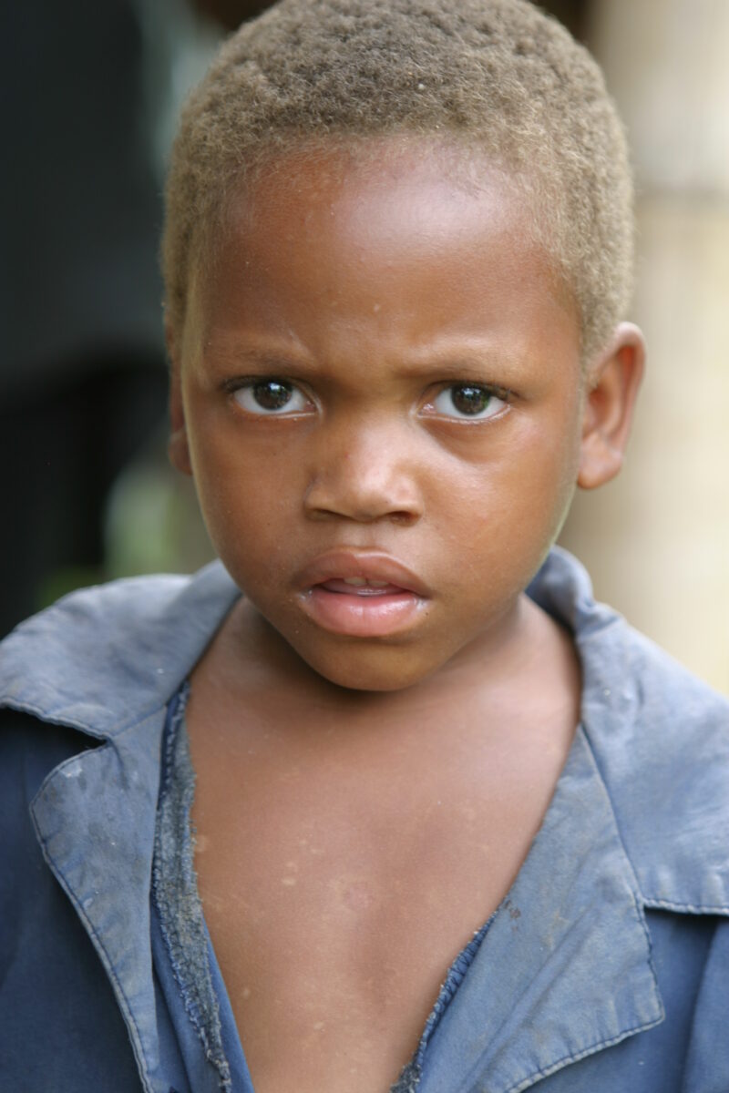Boy in Malawi — Stock image of boy living in Malawi, Africa — Malawi, Africa, faces, boy, boys