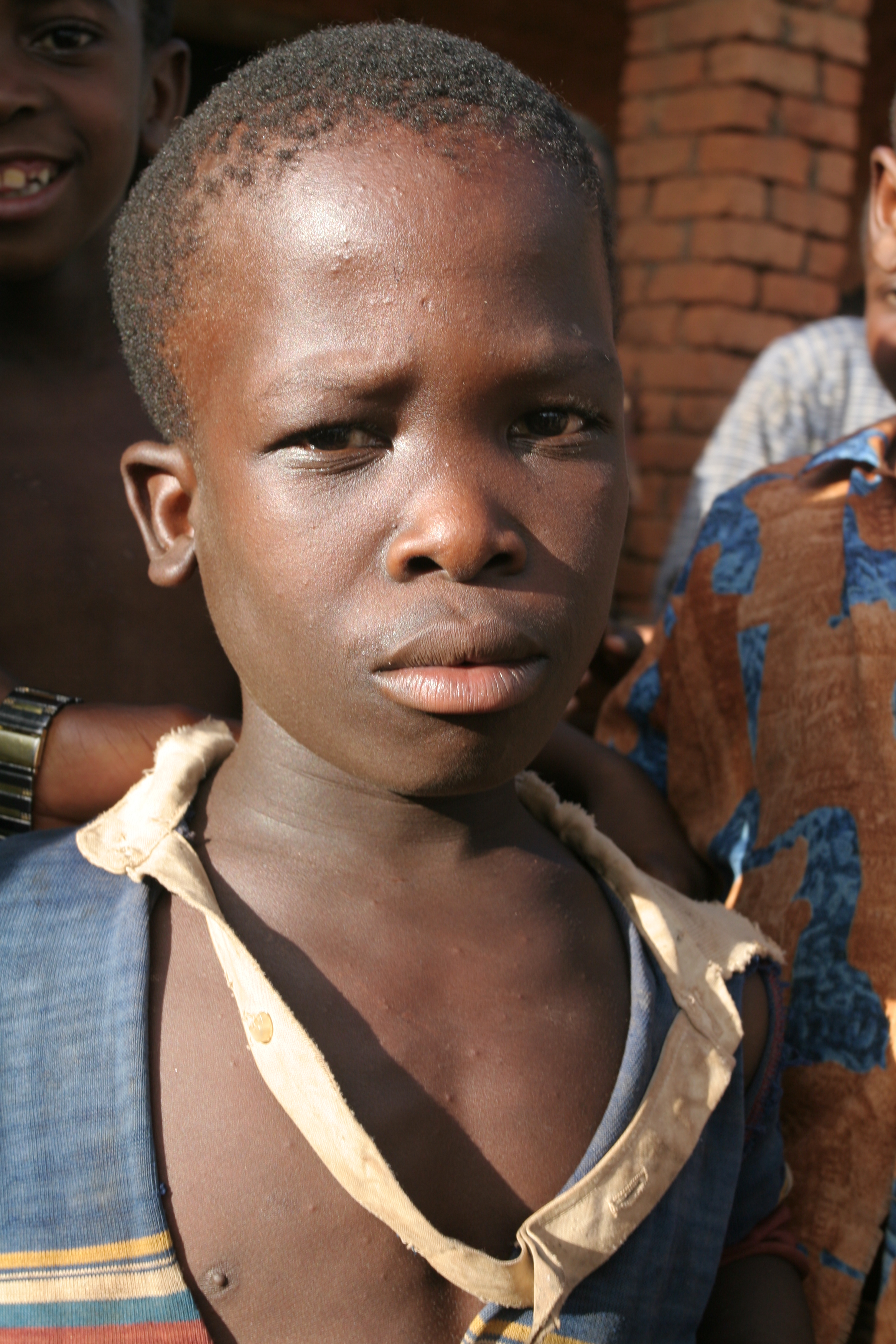 Boy in Malawi