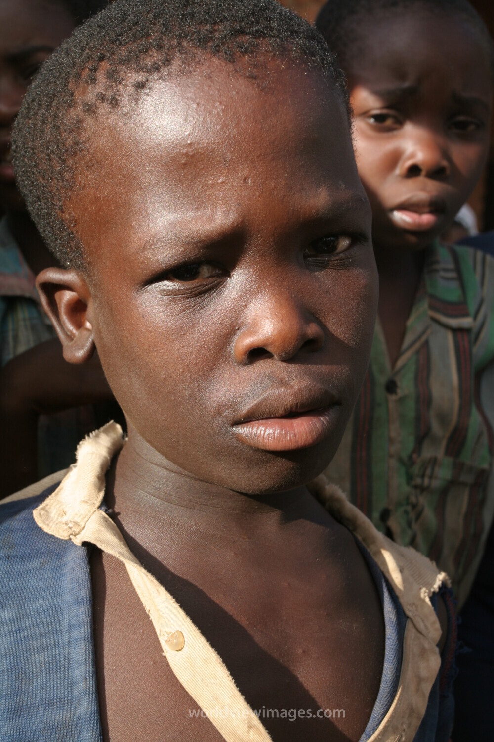 Boy in Malawi