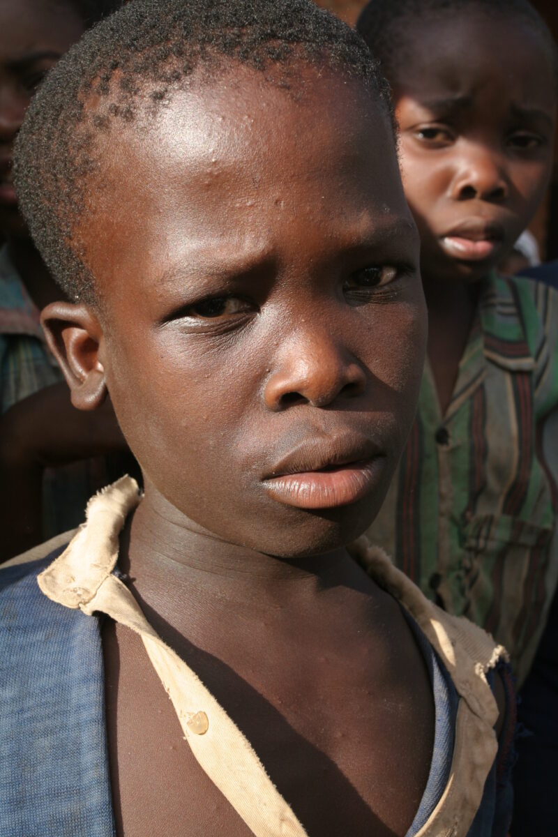 Boy in Malawi — Stock image of boy living in Malawi, Africa — Malawi, Africa, faces, boy, boys