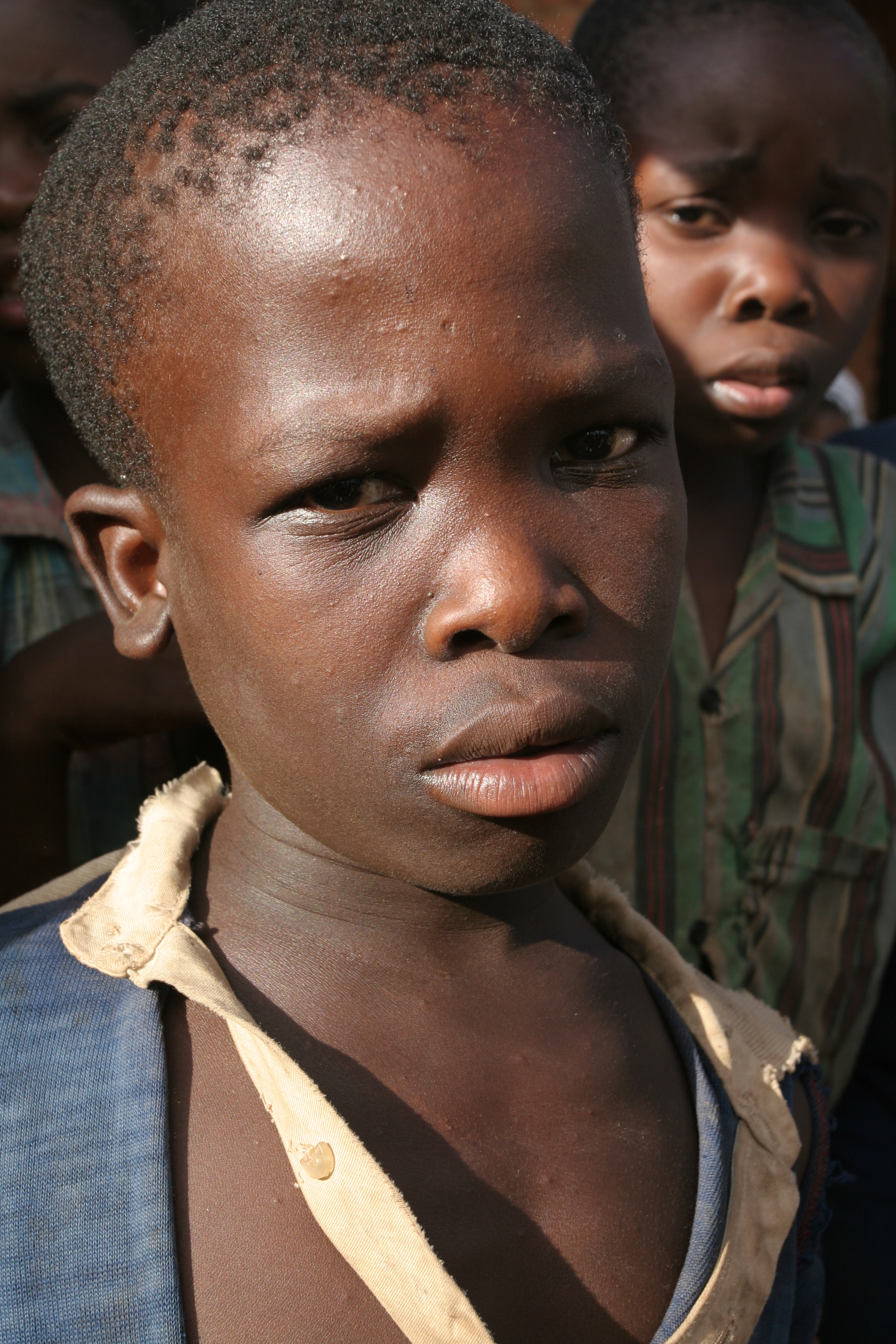 Boy in Malawi