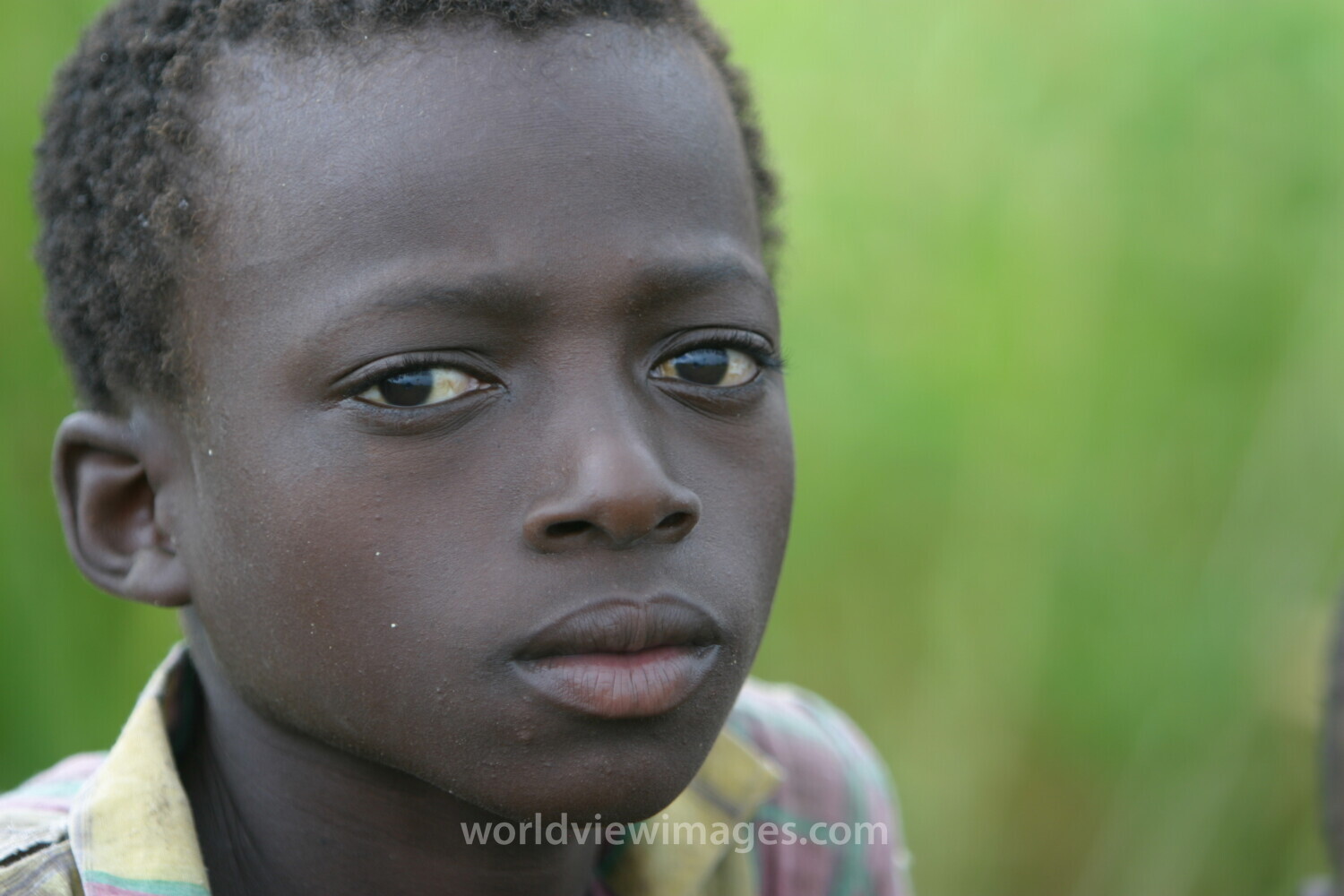 Boy in Malawi