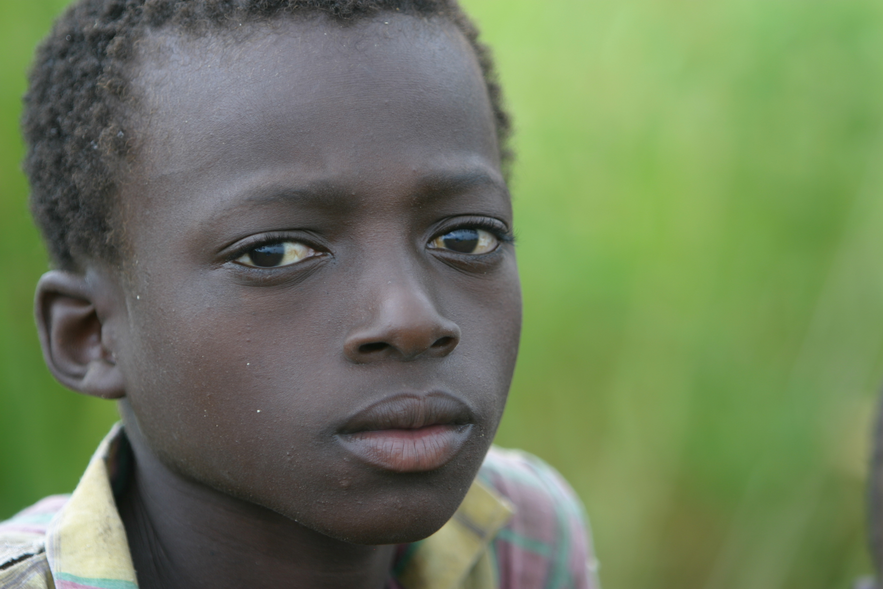 Boy in Malawi
