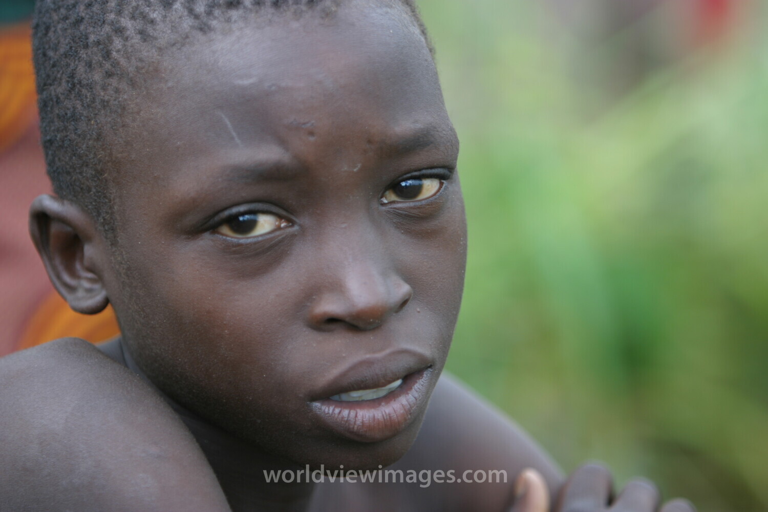 Boy in Malawi