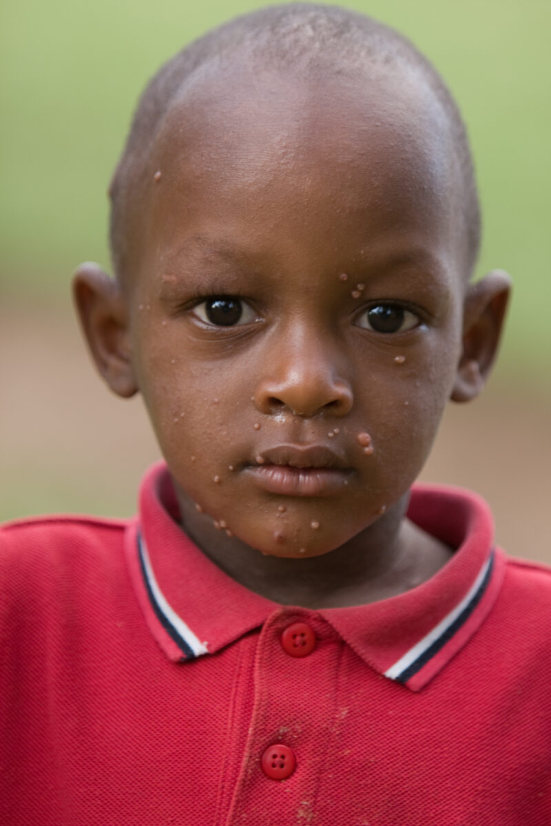 Boy in Rwanda — Boys growing up in a poor rural region of Rwanda after the return of refugees after the genocide. — Rwanda, boy, boys, child, children