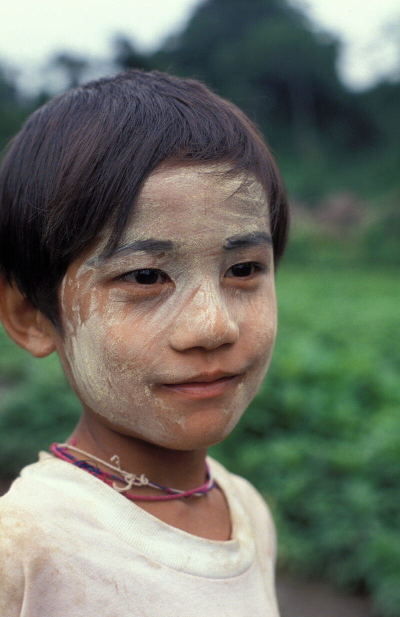 Karen Refugee Boy — Refugee boy living in a Karen refugee Camp in thailand — Karen, Burma, Myanmar, Thailand, Refugee