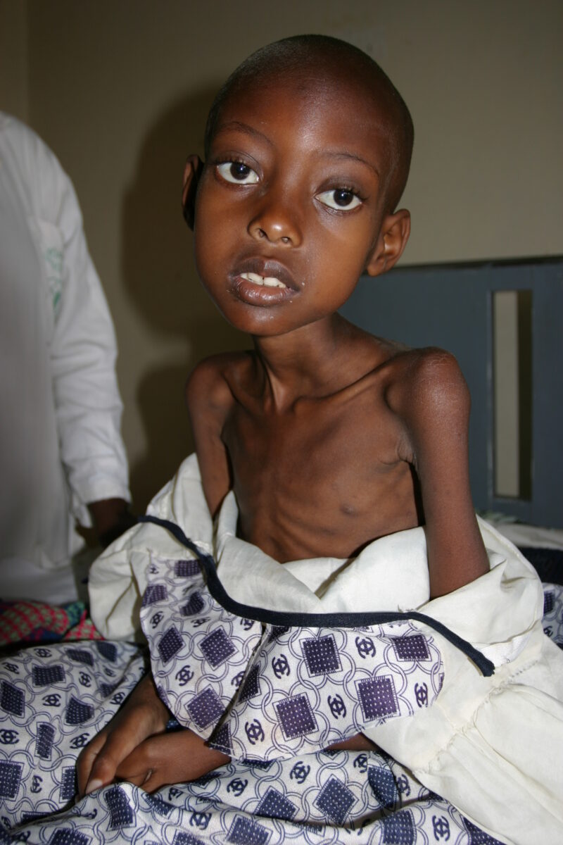 Girl with AIDS in Hospital — Girl in final stages of AIDS at a hospital in Rwanda — Rwanda, Africa, health, poor, girl