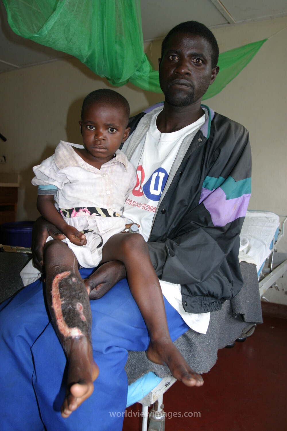 In the Hospital in Rwanda