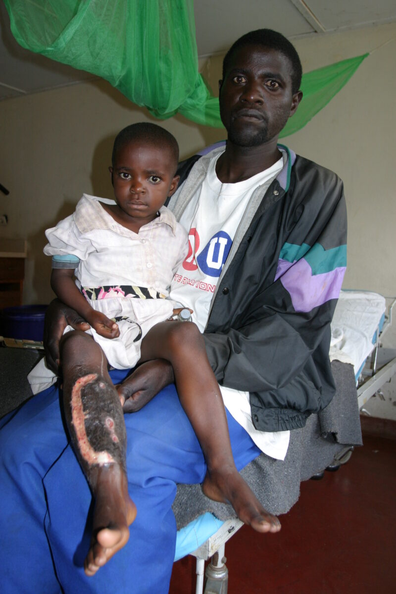 In the Hospital in Rwanda — Stock image of hospital/clinic in Rwanda, Africa — Rwanda, Africa, health, hospital, sick