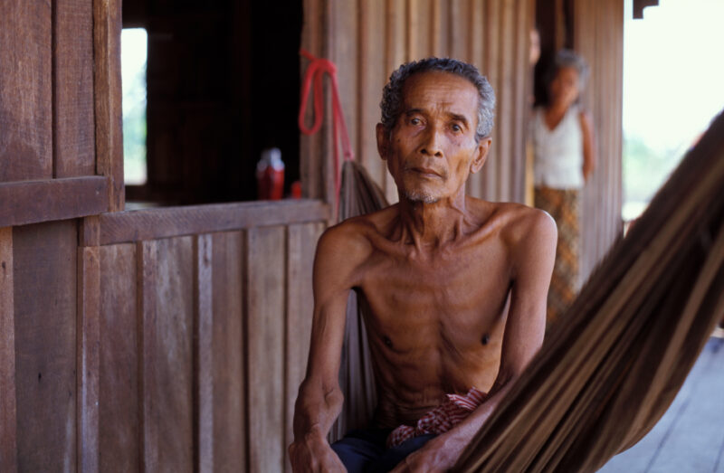 Man with TB in Cambodia — Stock image of man in Cambodia with TB, HIV/AIDS — Cambodia, Health, HIV, AIDS, Tuberculosis