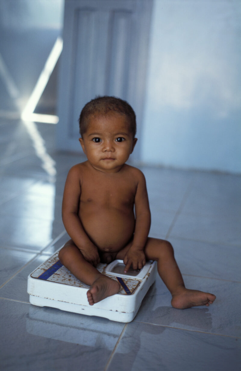 Growth Monitoring in Cambodia — Stock image of baby getting weighed at a remote ADRA health clinic in Cambodia — Cambodia, health clinic, baby, growth record...