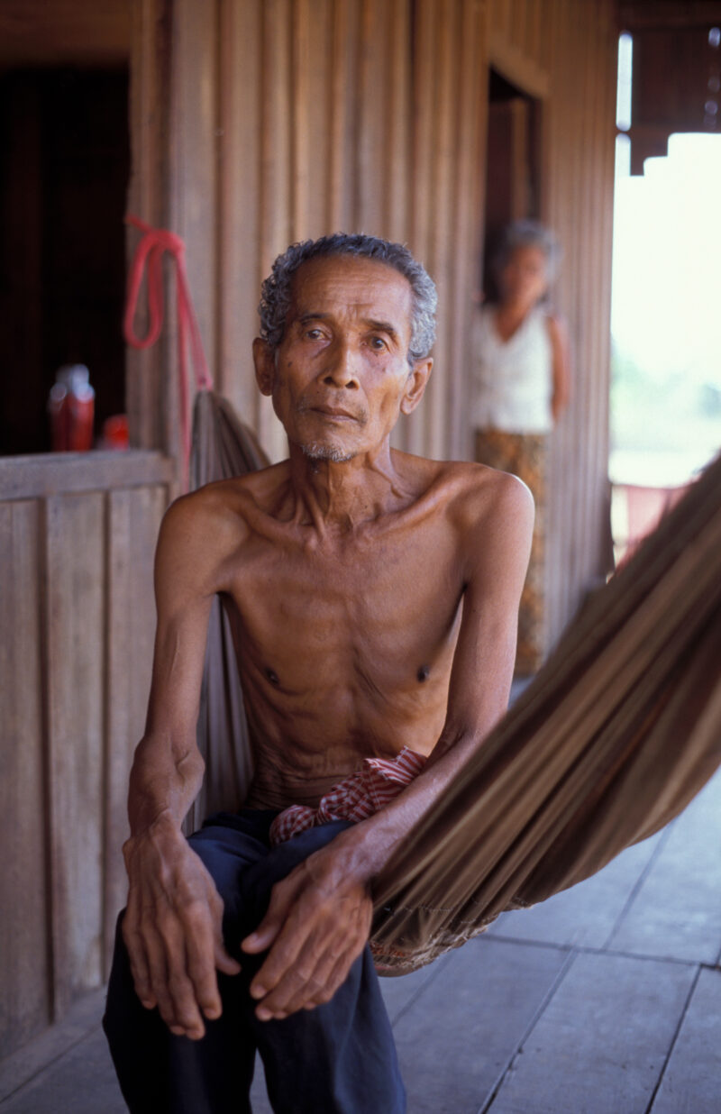 Man with TB in Cambodia — Stock image of man in Cambodia with TB, HIV/AIDS — Cambodia, Health, HIV, AIDS, Tuberculosis