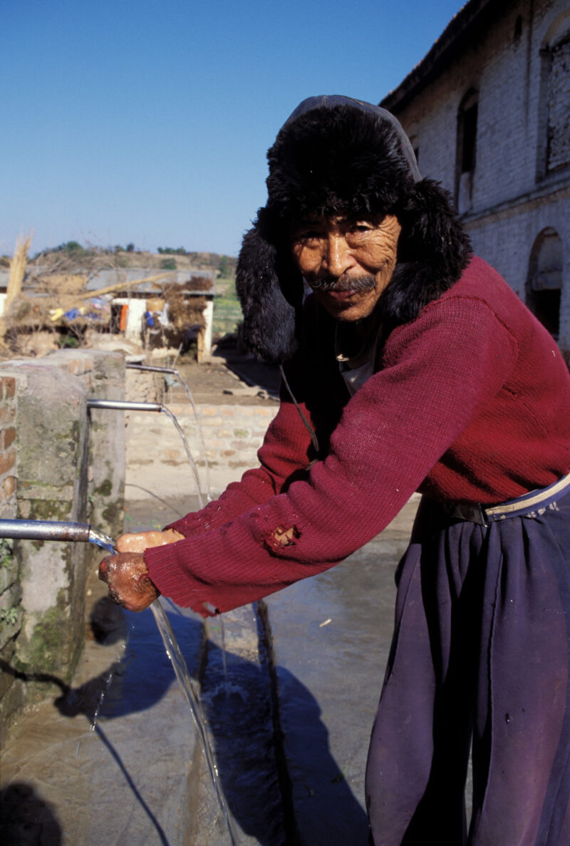 Man with Leprosy in Nepal — Stock images of people with leprosy at a leper colony in Nepal — Nepal, Health, leper, lepers, leper colony