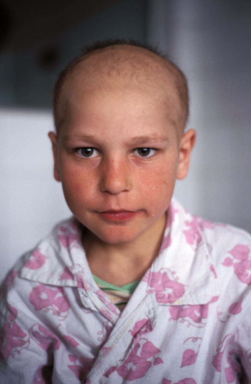 Girl in Hospital in Romania — Stock Images of Children in a cancer ward of a hospital in Bucharest, Romania — Romania, Cancer, Children, hospital, Chernobyl
