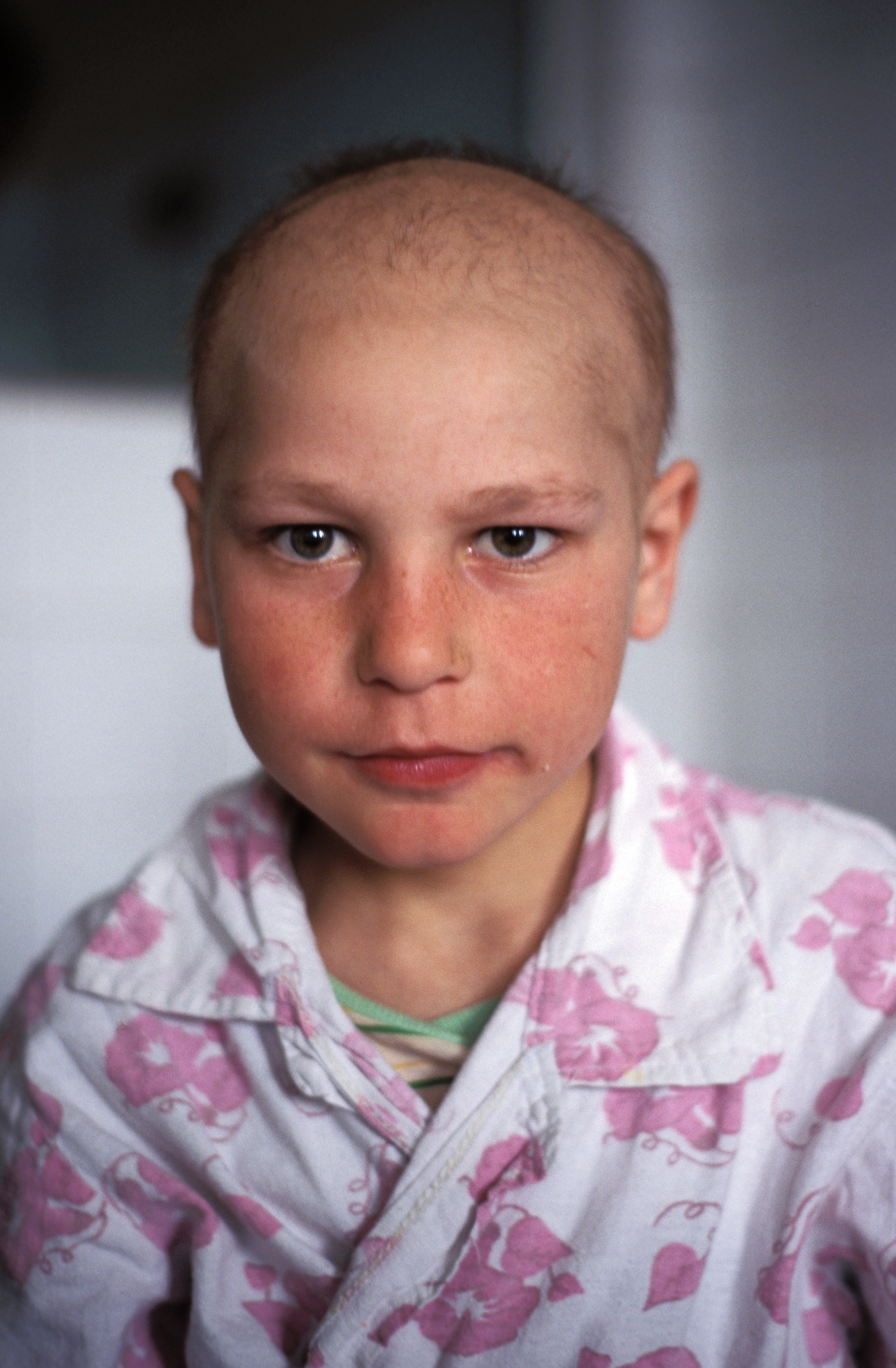 Girl in Hospital in Romania