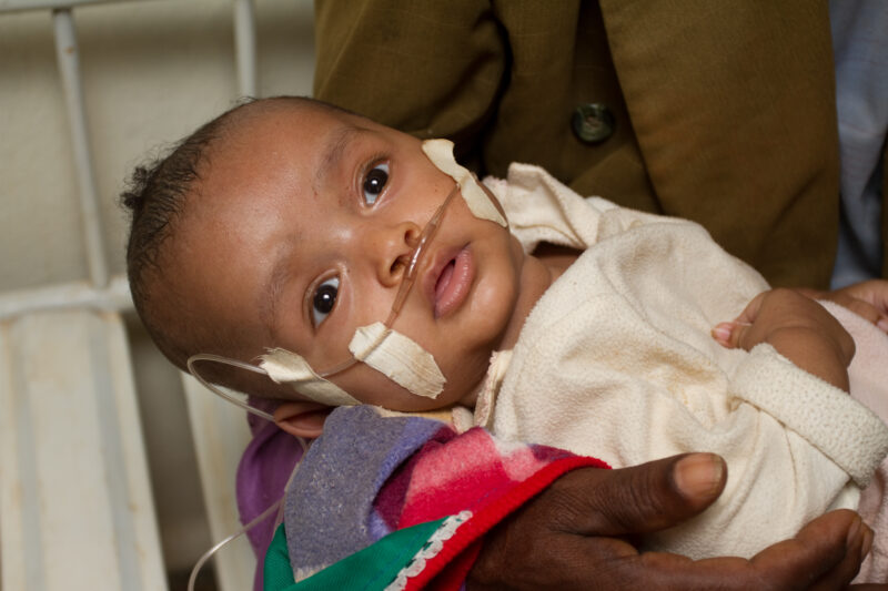 Sick Baby in Ethiopia — Stock shots of Gimbii Adventist Hospital in Ethiopia, Africa — Ethiopia, Africa, African, Africans, Ethiopian