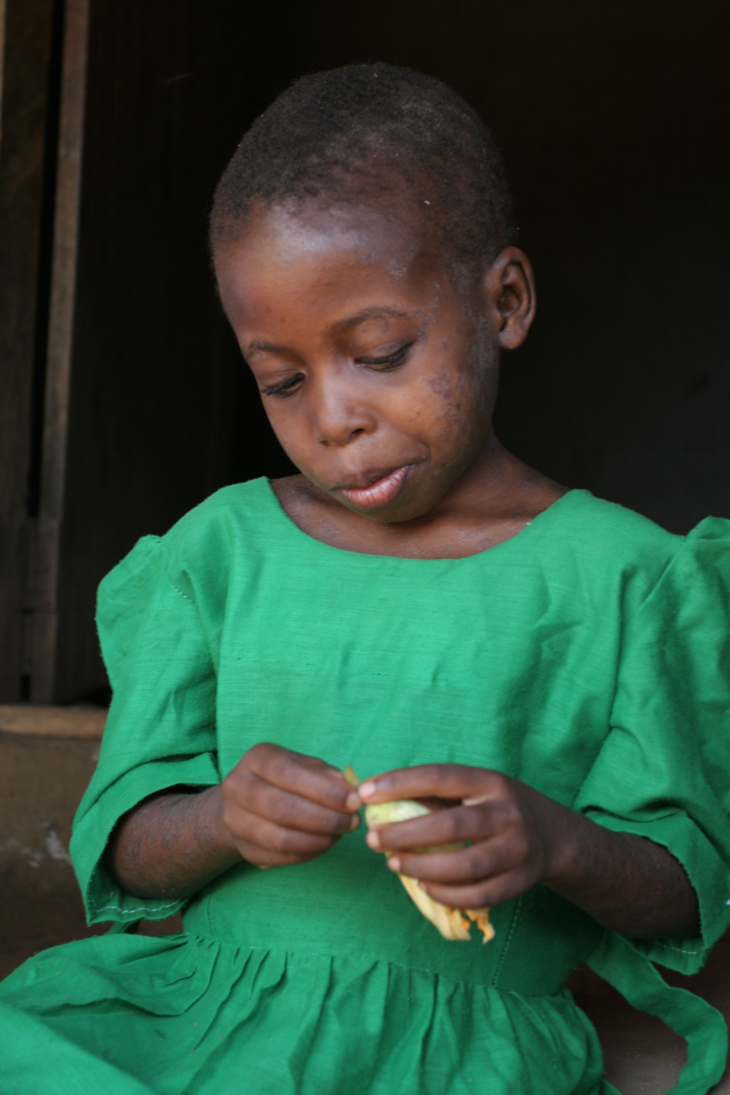 HIV Positive Girl in Malawi