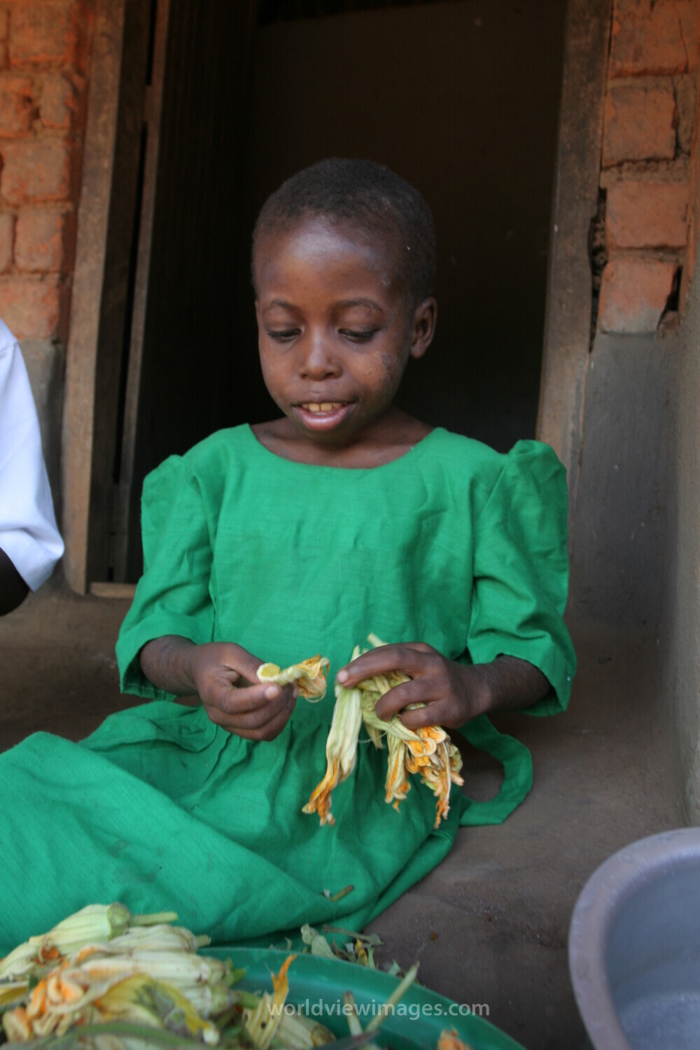 HIV Positive Girl in Malawi