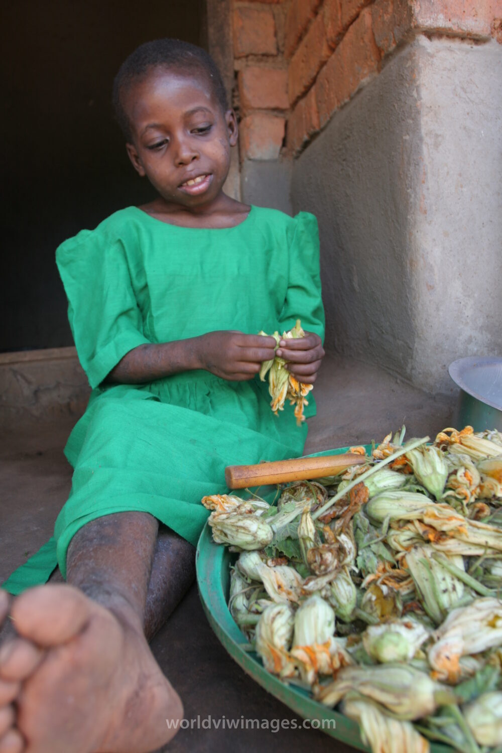 HIV Positive Girl in Malawi