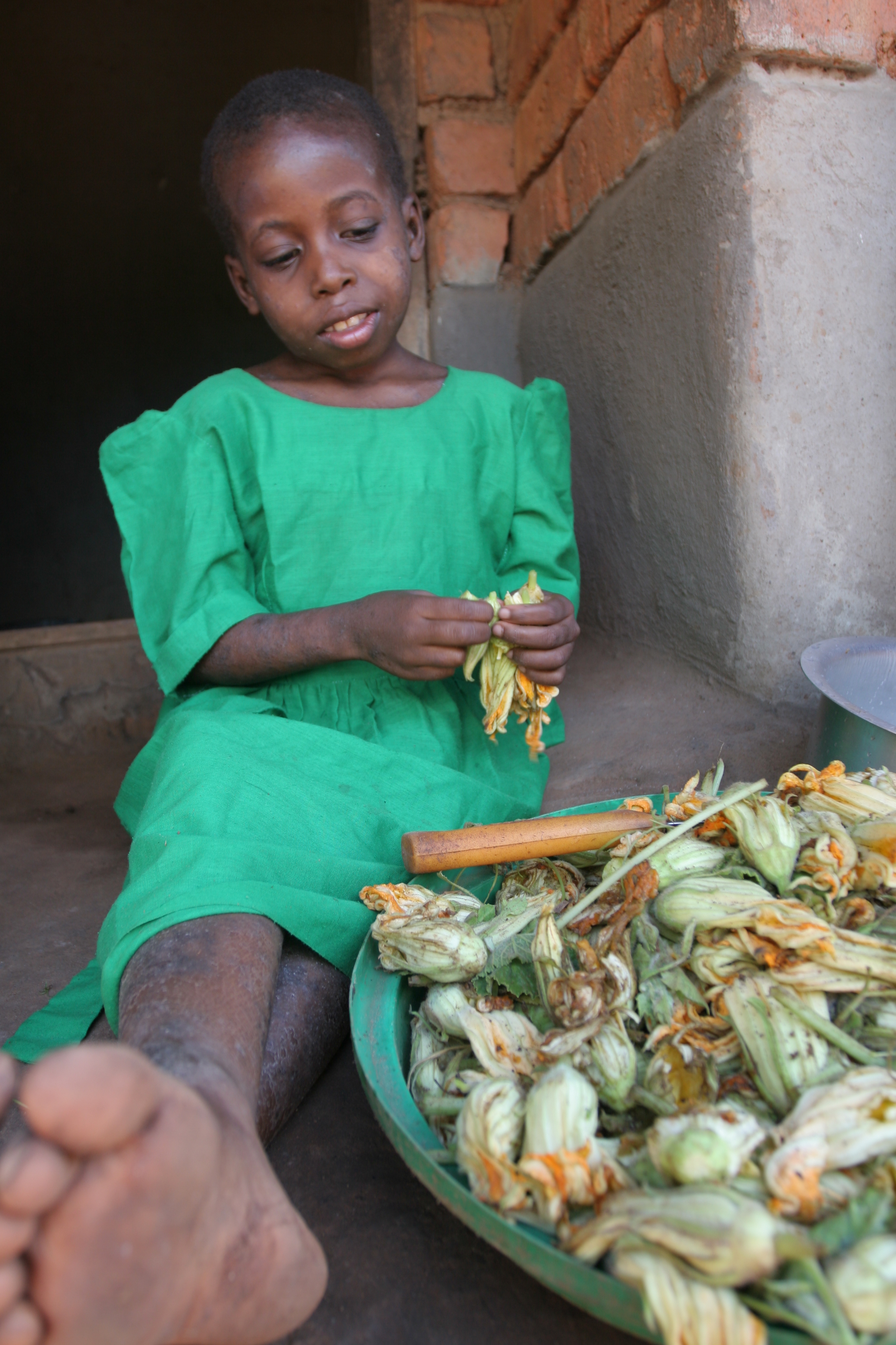 HIV Positive Girl in Malawi